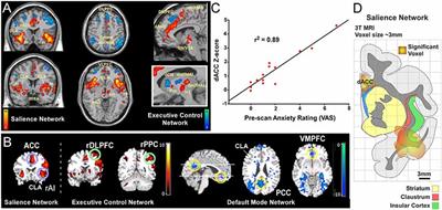 A Role for the Claustrum in Salience Processing?